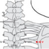 Poumon Psy - Image 4